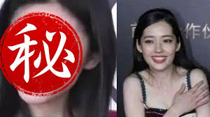 【 高 俊 雄 教 授 】. åŠŸå¤« é½™ç‰™ççœŸé¢ç›®æ›å…‰ç«Ÿæ'žè‡‰éƒ­ç¢§å©· æ±æ£®æ–°èž