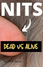 Image result for lice vs nits