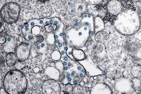 Coronavirus Evolved Naturally And Is Not A Laboratory Construct Genetic Study Shows
