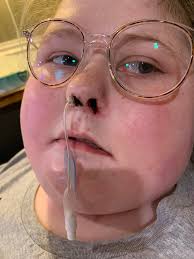 Isabelle's Fight: Not All Cancer Is Pink