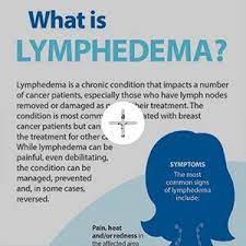 For example, over 480,000 people die in the u.s. Lymphedema Reducing Symptoms Side Effects Ctca