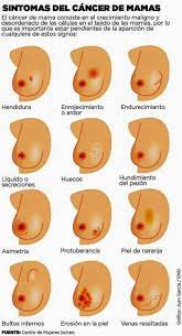 Sintomas Del Cancer De Mamas Educacion Para La Salud Cuidado De La Salud Consejos Para La Salud