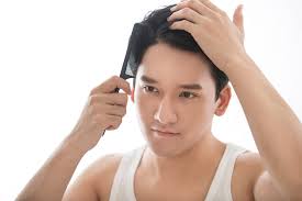 防脫髮洗頭水】運動員長期大壓力易禿頭？6大防甩髮洗髮露推介