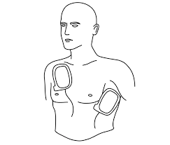 Image result for Transcutaneous Pacing