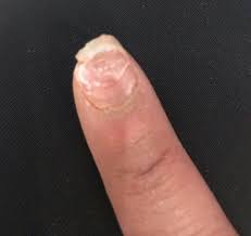 This thins your natural nails, making them weaker. Artifical Nails 101 How To Make Sure You Have A Nail Tech And Not A Nail Wreck