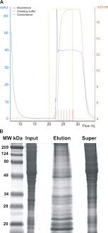 Скачать super pro metal detector apk 1.0 для андроид. Phosphoproteomic Analysis Of The Mouse Brain Cytosol Reveals A Predominance Of Protein Phosphorylation In Regions Of Intrinsic Sequence Disorder Molecular Cellular Proteomics