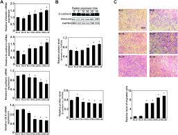 The gas detector (radon detector) for domestic use is an electronic device that detects the presence inside the house of gases harmful to health. Radon Induced Mitochondrial Dysfunction In Human Bronchial Epithelial Cells And Epithelial Mesenchymal Transition With Long Term Exposure Toxicology Research Rsc Publishing