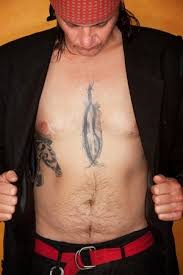 Sometimes, a surgical scar turns into a keloid. Can Scars Be Tattooed Over Sophisticated Edge