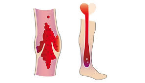 Pin On Cardiovascular System