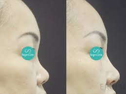 We provide a comprehensive range of services from cosmetic skincare, facial. Top 3 Dermatologist Skin And Specialist Clinics In Penang Price Guide Reviews