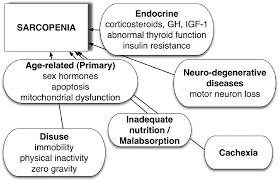 Sarcopenia typically happens faster around age 75. Mechanisms Of Sarcopenia Download Scientific Diagram