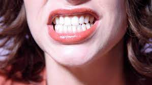What Your Gums Are Trying To Tell You