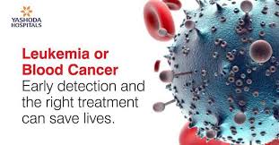 Оur address is alekseev street, kurgan basic medical college. Early Symptoms Of Leukemia Leukemia Or Blood Cancer Early Detection And The Right Treatment Can Save Lives