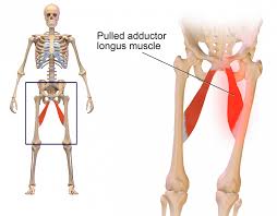 In the diagrams below, when you see muscle names that are the same color, it means they in the legs below, two more bones are to be noted: Groin Strain Symptoms Treatment And Recovery