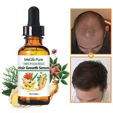 Besides good quality brands, you'll also find plenty of discounts when you shop for hair growth serum during big sales. Hair Growth Serum 2020 Hair Growth Treatment Hair Serum Anti Hair Loss Thinning Balding Repairs Hair Follicles Promotes Thicker Stronger Hair And Promotes Hair Regrowth Shopee Malaysia