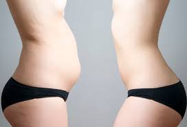 Dar ca sa stii, trebuie sa nu depasesti 36 de grame. Fructe Care Slabesc Burta Despre ViaÈ›a Din Romania