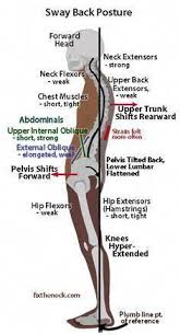 Pin On Stop That Annoying Backache