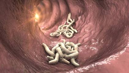 Roup dětský (Enterobius vermicularis), vygenerováno umělou inteligencí