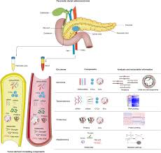 Find out how pancreatic cancer is tested for, diagnosed, and staged. Coupled Liquid Biopsy And Bioinformatics For Pancreatic Cancer Early Detection And Precision Prognostication Molecular Cancer Full Text