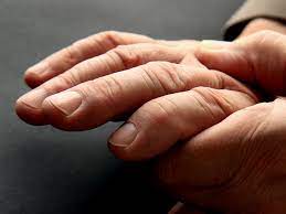 About two shots (3 oz) of liquor. Swollen Fingers 11 Causes And When To Call The Doctor Silversneakers