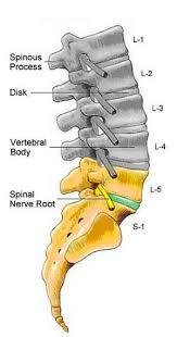 Ayurvedic Treatment Of L5 S1 Slip Disc Without Surgery