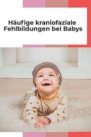 haufige kraniofaziale fehlbildungen bei babys kraniofaziale fehlbildungen gehoren zu den haufigsten geburtsfehlern bei sauglingen baby kopfform baby saugling