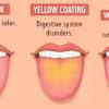 However, if this does not help, you might have a bigger bacterial. 1