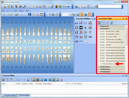 Dentrix Tip Tuesdays Customizing The Procedure Code List In