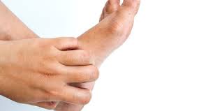 Maybe you would like to learn more about one of these? Telapak Kaki Gatal Bisa Disebabkan Oleh 10 Hal Ini Apa Saja