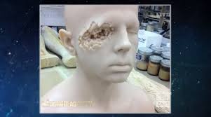 Figure 6.48 this is another example of a graze wound or a gutter wound. How Did Carl Survive The Eyeshot Movies Tv Stack Exchange
