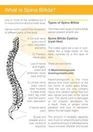 Www Shinecharity Org Uk What Is Spina Bifida Spina Bifida Hydrocephalus Information Networking Spina Bifida Spina Bifida Awareness Spina Bifida Facts