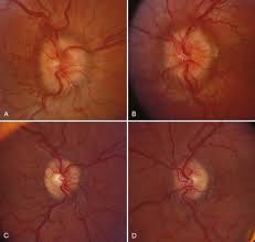 Image result for Pseudoeriosema