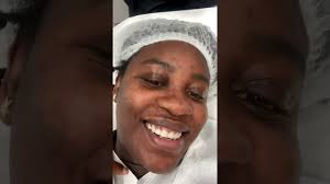 How to get a glowing black skin #youtubeshorts #skincaretips  #microdermoabrasion #selfcareroutine