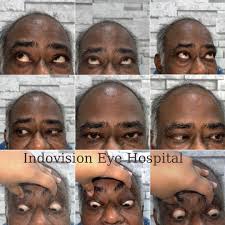 Eye Care Counselling Services in Pune