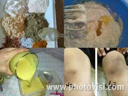 خلطة بياض الثلج لتبيض الوجه و الجسم و المناطق الحساسة بسرعة رهيبة ب 3 ايام فقط Natural Skin Care Diy Beauty Care Diy Skin Care