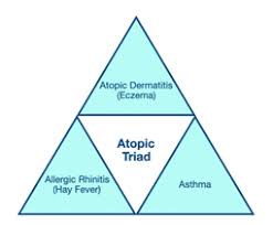 Image result for Allergic Triad