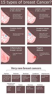 Some are more common than others, and there are also combinations of cancers. What Is Breast Cancer Causes Types Prevention And Diagnosis