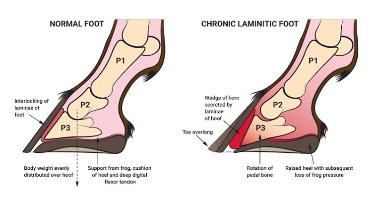 Normal vs. Chronic Laminitic Hoof Anatomy, AI generated