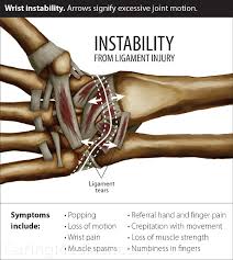 Also people who stand for prolonged period of time during their job duties are also at risk for injuring or straining the flexor retinaculum of the foot. Snapping Wrist The Extensor Carpi Ulnaris Ecu Tendon The Extensor Pollicis Brevis And The Distal Radioulnar Joint Caring Medical Florida