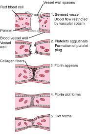 Blood clots are treatable if caught early, so knowing how to recognize symptoms is important. Clotting Definition Of Clotting By Medical Dictionary