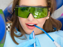 Laser Periodontal