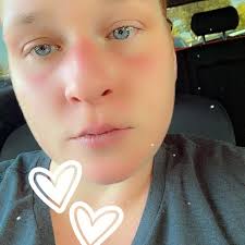 Did anyone else get told they cannot smoke or ingest THC or CBD ever again  after GS surgery