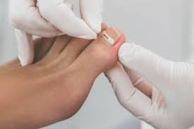 Image result for Toenail Removal