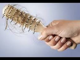 النساء واسباب تساقط الشعر اسباب تساقط الشعر عند النساء وطرق حلها منع تساقط الشعر Diabetic Hair Loss Hair Loss Women Hair Loss Remedies