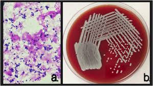 Image result for Corynebacterium