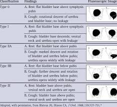 Image result for Stress Incontinence