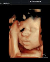 Morfologiile fetale sunt printre cele mai importante investigații din  timpul sarcinii și momentele în care viitorii părinți află informații  detaliate esențiale despre sănătatea și dezvoltarea bebelușului. Aici,  experiența și atenția medicului fac