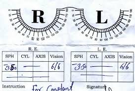 computerized eye testing final part a childs eye a