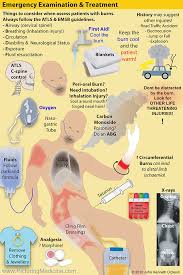 Image result for Burn Management