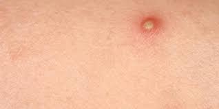 Ruyada Irin Gormek Ne Anlama Gelir